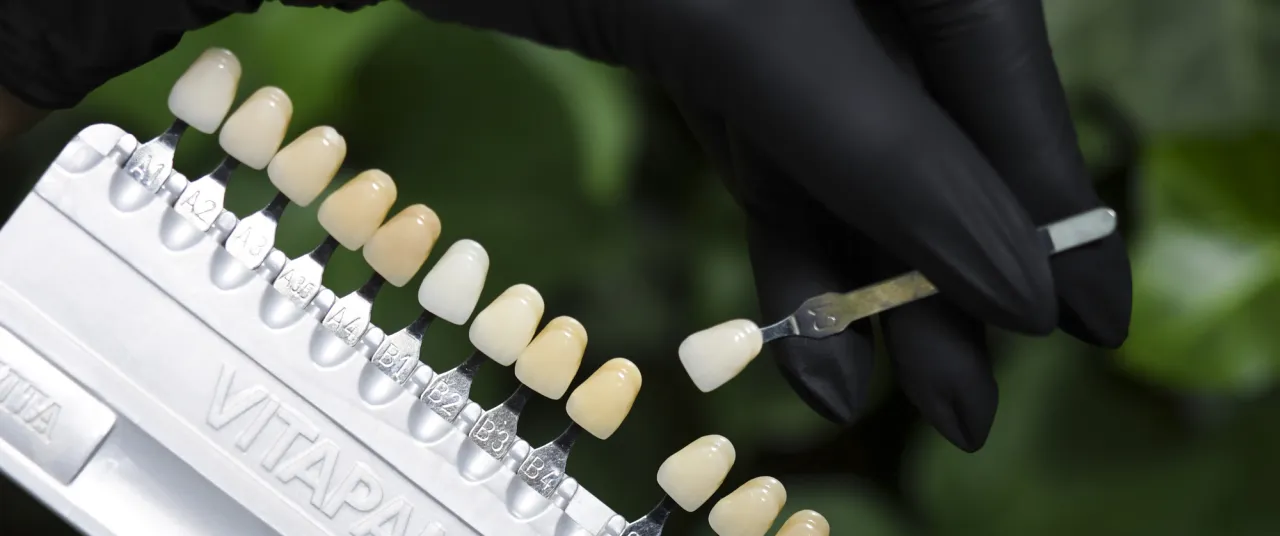 dobór koloru zębów w studio stomatologii estetycznej