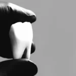 makieta zęba trzymana w dłoni w rękawiczce chirurgicznej w studio stomatologii estetycznej