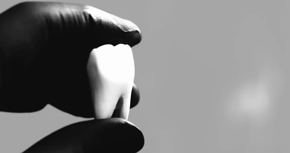 makieta zęba trzymana w dłoni w rękawiczce chirurgicznej w studio stomatologii estetycznej