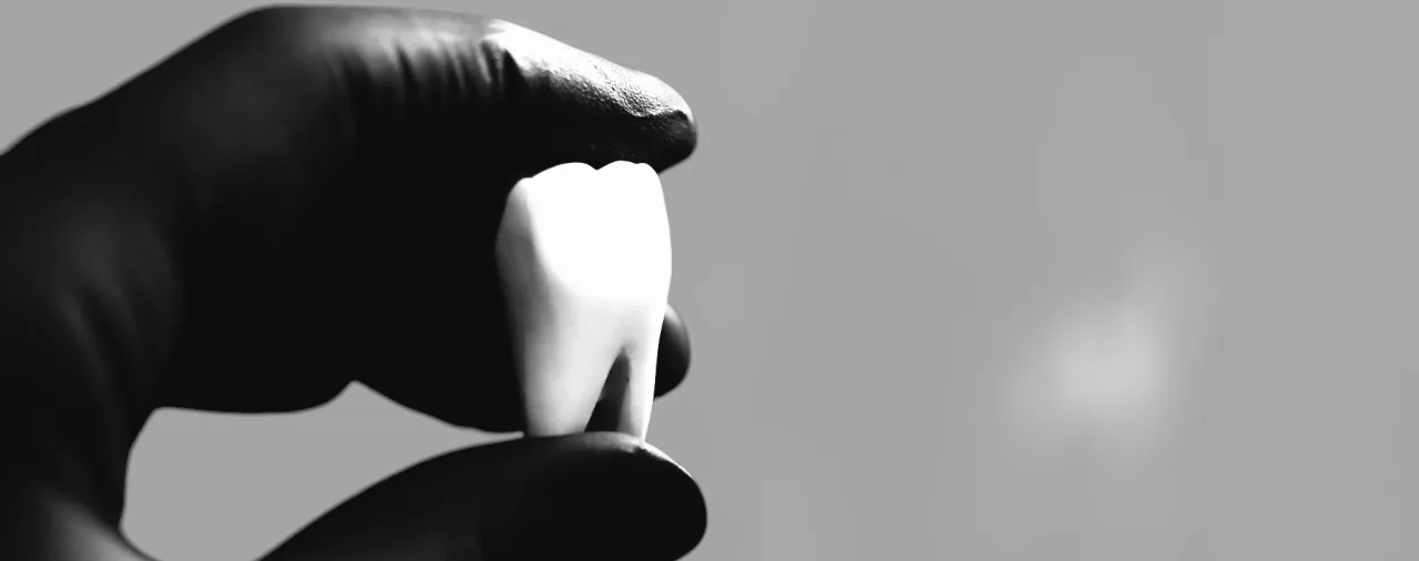 makieta zęba trzymana w dłoni w rękawiczce chirurgicznej w studio stomatologii estetycznej