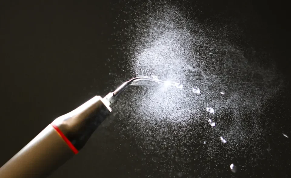 higienizacja zębów w studio stomatologii estetycznej