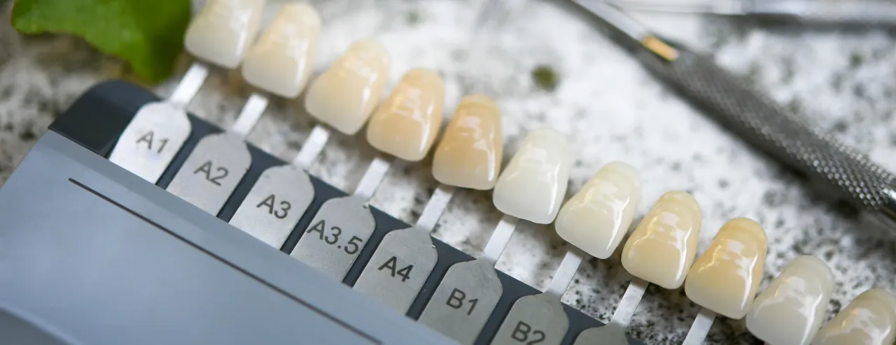 kolornik zębów w studio stomatologii estetycznej se batorego