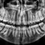 Badanie radiologiczne w stomatologii   Studio Stomatologii Estetycznej