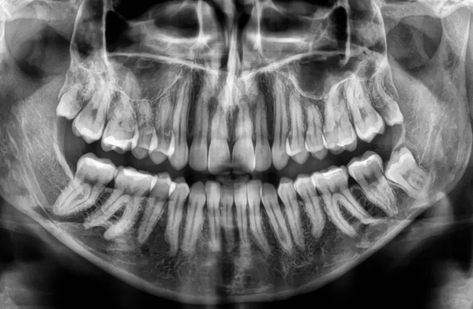 Badanie radiologiczne w stomatologii   Studio Stomatologii Estetycznej