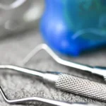 Płytka nazębna i kamień czym się różnią   Studio Stomatologii Estetycznej