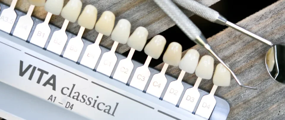 kolornik i zestaw diagnostyczny w studio stomatologii estetycznej