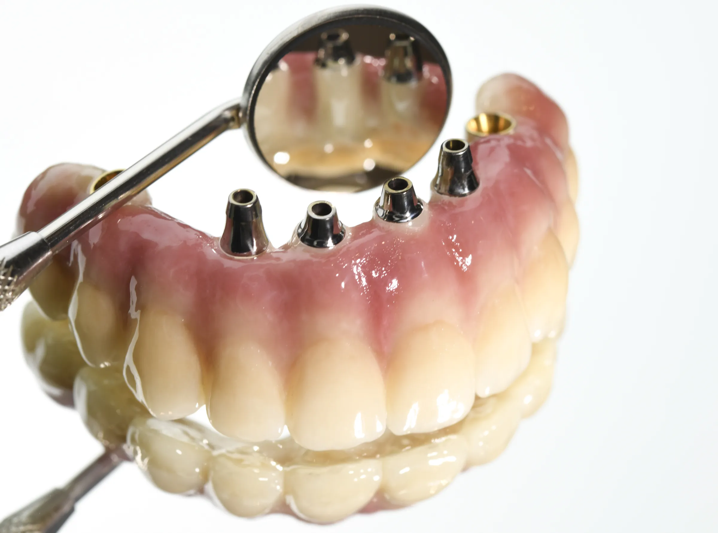 most na implantach w studio stomatologii estetycznej