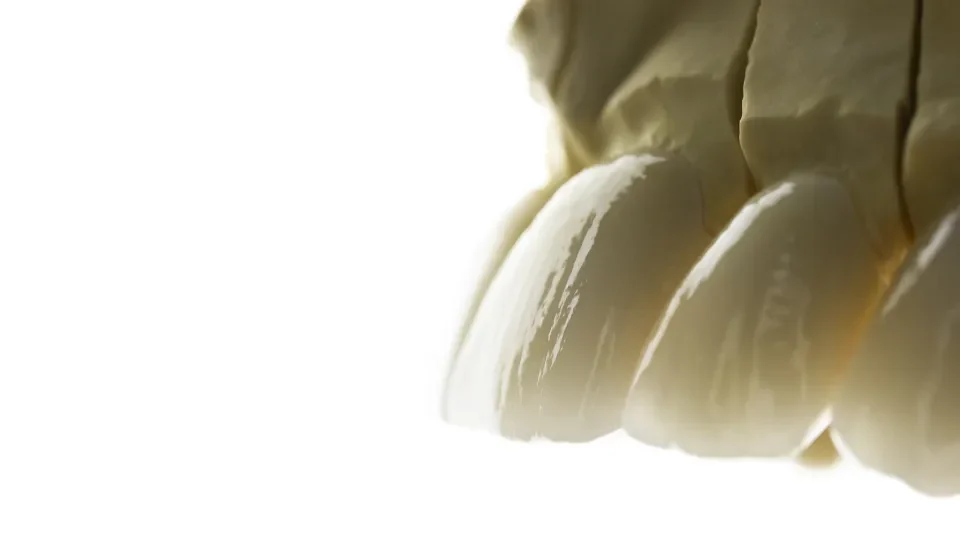 Protetyka licówki jaka cena w Studio Stomatologii Estetycznej