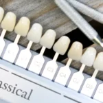 kolornik i zestaw diagnostyczny w studio stomatologii estetycznej