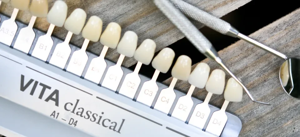 kolornik i zestaw diagnostyczny w studio stomatologii estetycznej