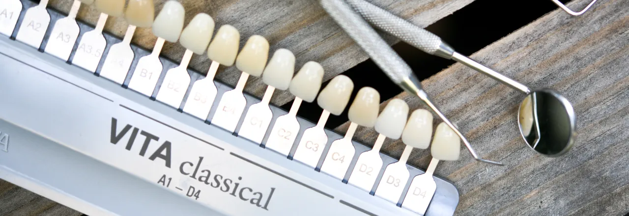 kolornik i zestaw diagnostyczny w studio stomatologii estetycznej