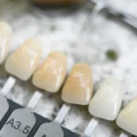 kolornik do zębów pomocny w ocenie czy wybielanie zębów niszczy szkliwo