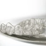 Co jest lepsze ortodontyczny aparat stały czy ruchomy   Studio Stomatologii Estetycznej