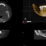 RTG 3D zębów wykonany w gabinecie dentystycznym Studio Stomatologii Estetycznej Kraków ulica Batorego