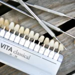 Kolornik stomatologiczny i dentystyczny zestaw diagnostyczny w Studiu Stomatologii Estetycznej w Krakowie na ulicy Batorego