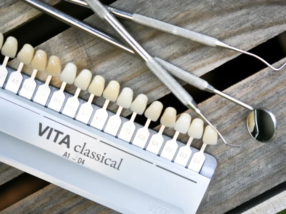 Kolornik stomatologiczny i dentystyczny zestaw diagnostyczny w Studiu Stomatologii Estetycznej w Krakowie na ulicy Batorego