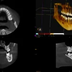 Tomograf w diagnostyce stomatologicznej pracownia RTG w Studio Stomatologii Estetycznej Kraków ulica Batorego