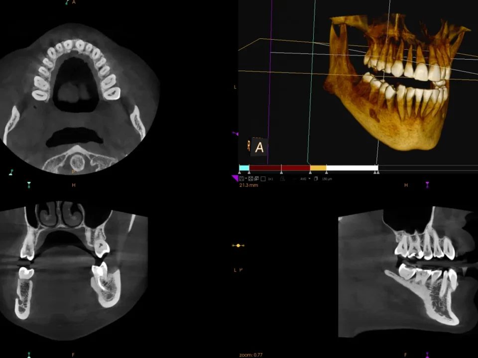 Tomograf w diagnostyce stomatologicznej pracownia RTG w Studio Stomatologii Estetycznej Kraków ulica Batorego