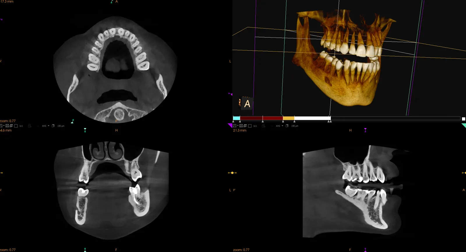 Tomograf w diagnostyce stomatologicznej pracownia RTG w Studio Stomatologii Estetycznej Kraków ulica Batorego