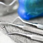 Kserostomia - suchość w ustach - leczenie - Studio Stomatologii Estetycznej Kraków ulica Batorego