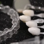 Czym wybielać zęby w Studio Stomatologii Estetycznej