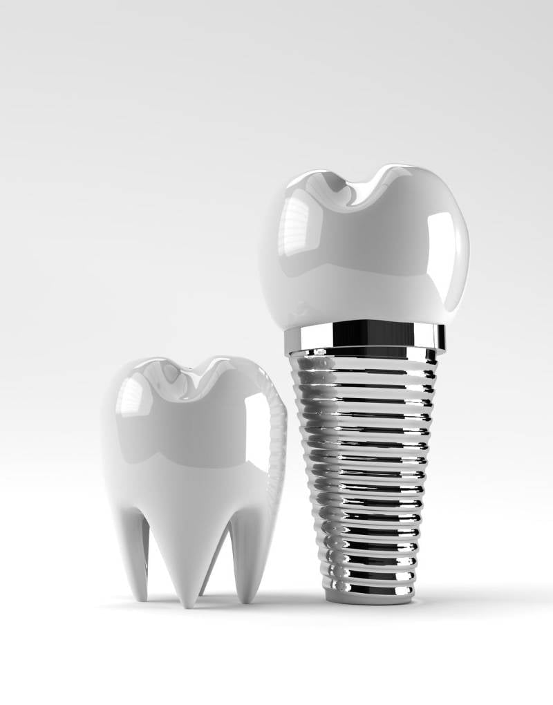 Implanty stomatologiczne zdjecie  (1)
