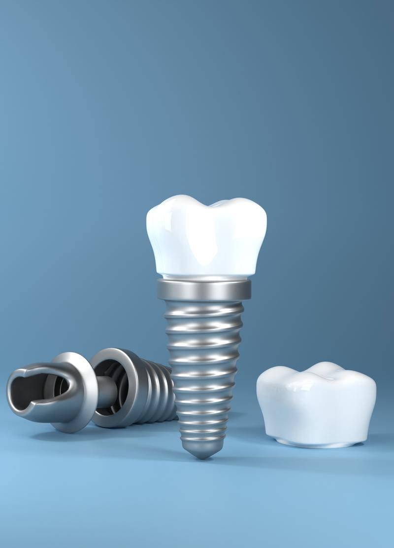 Implanty stomatologiczne zdjecie  (7)