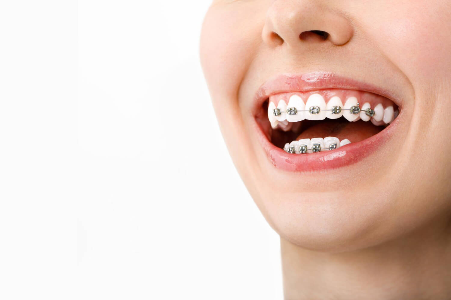 Ortodonta zdjecie (1)