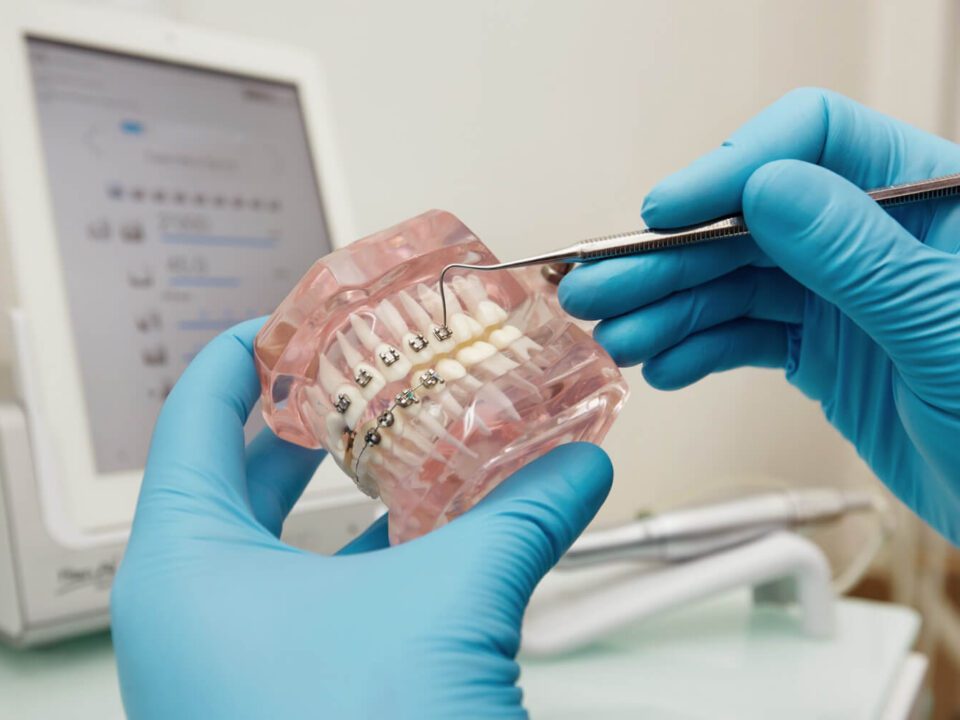 aparaty ortodontyczne zdjecie 2