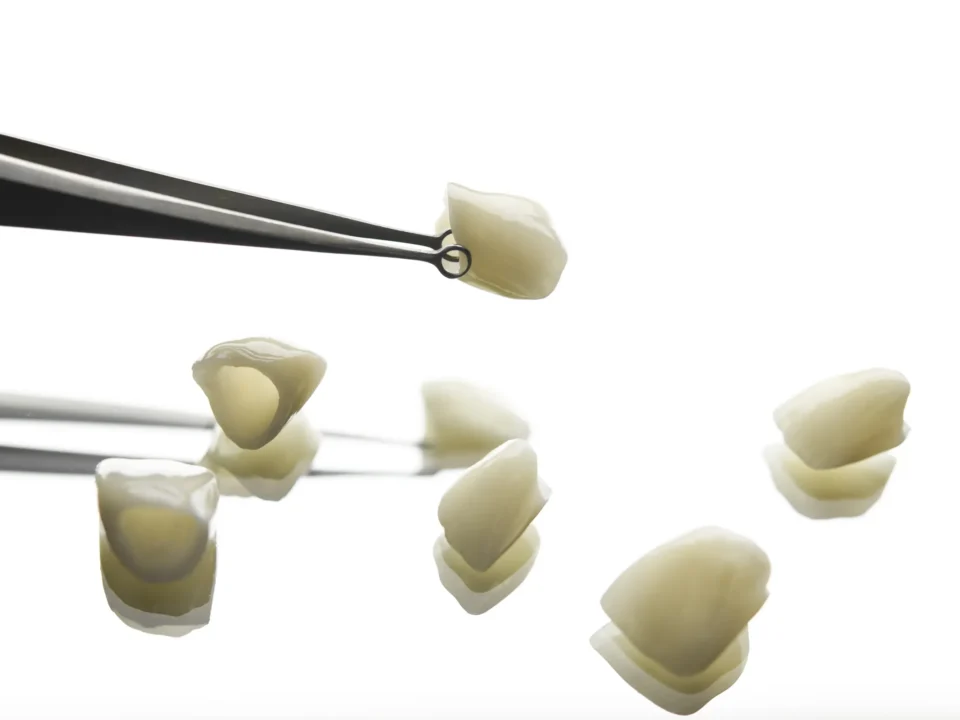 Gotowe korony porcelanowe i pęseta stomatologiczna