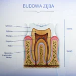 Kanały zęba oczyszczane w leczeniu kanałowym pokazane na schemacie przedstawiającym budowę zęba