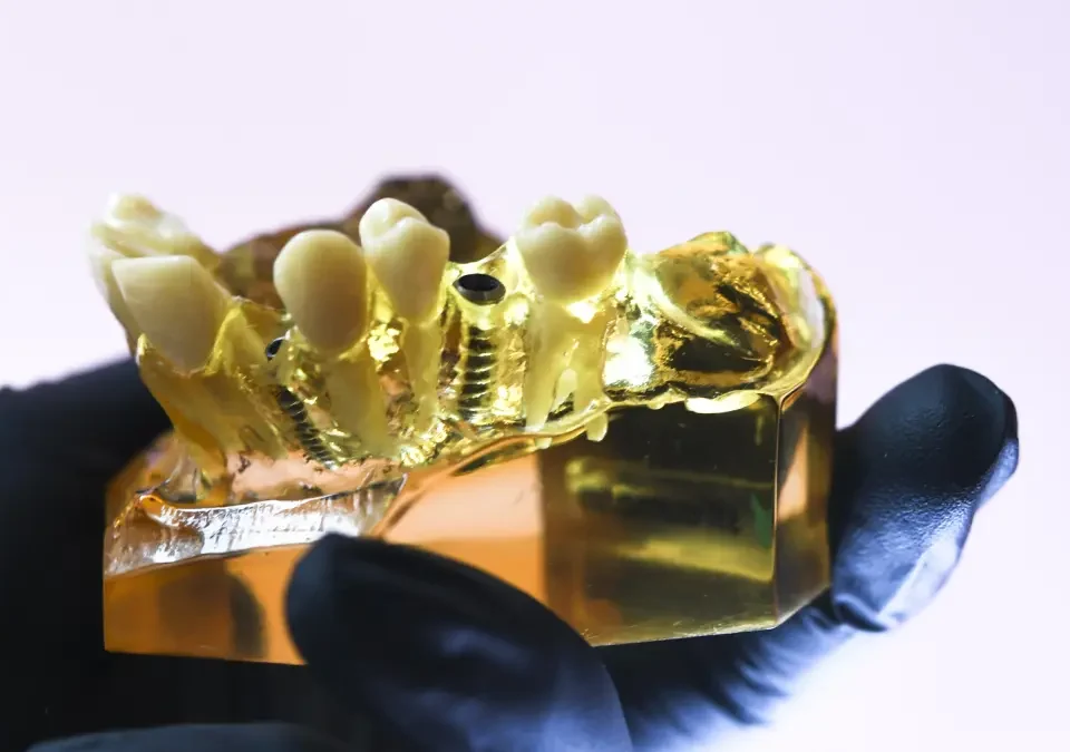 Dentysta na raty w Krakowie - usługa obejmująca implanty, protezy, protetykę i ortodoncję w Studio Stomatologii Estetycznej